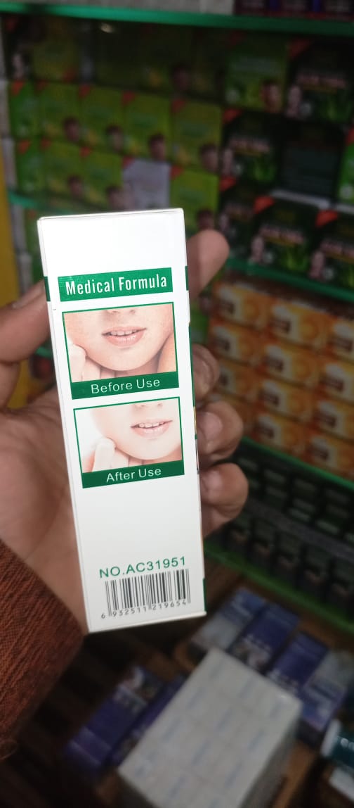 Anti-Freckle Whitening Facial Serum – 30ml Brightening Formula for Clear, Even-Toned Skin