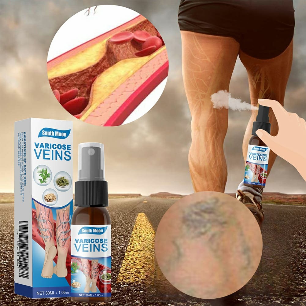 South Moon Varicose Veins Treatment Spray – 35ml Advanced Formula for Spider Veins, Leg Pain & Swelling Relief | Natural Herbal Spray for Better Circulation