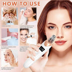 Electric Blackhead Remover | Vacuum Acne & Pore Cleaner | 5 Heads Suction Machine | Skin Care & Exfoliating Tool