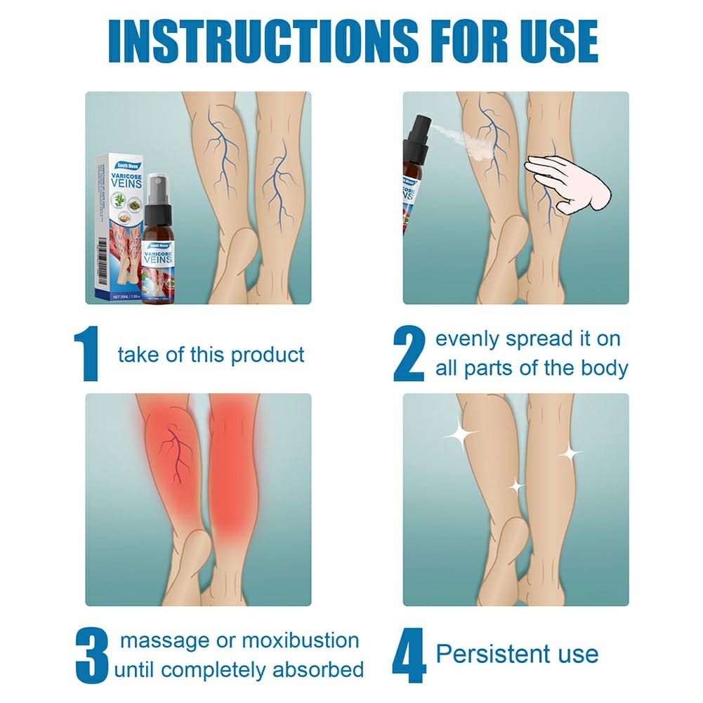 South Moon Varicose Veins Treatment Spray – 30ml Advanced Formula for Spider Veins, Leg Pain & Swelling Relief | Natural Herbal Spray for Better Circulation