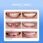 Snap On Smile - Veneers Teeth for Men and Women - Moldable False Artificial Braces Teeth