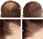 2in1 Hairline &amp; Eyebrow Shaping Stamp