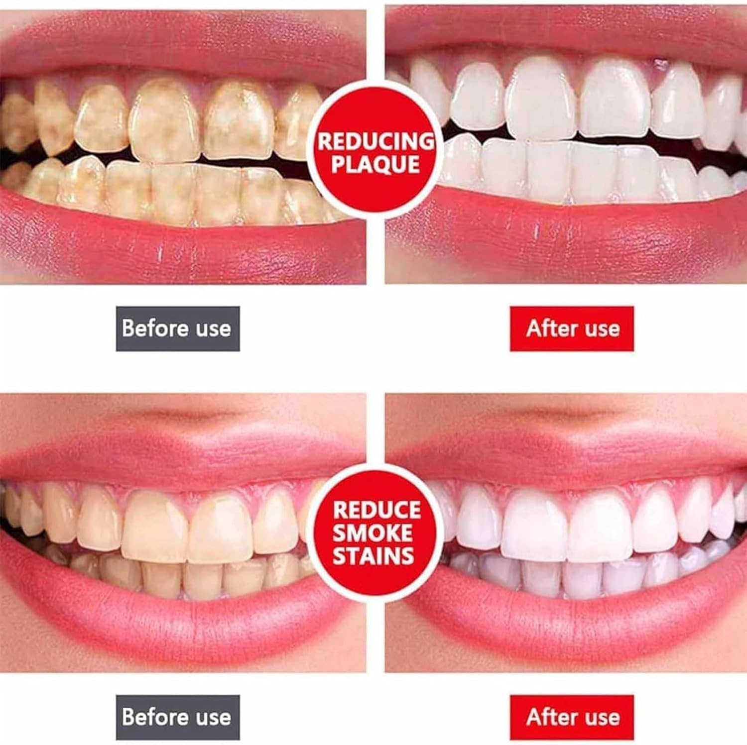 Yayashi Sp-4 Ultra Whitening Toothpaste Probiotic Stain Remover 100ml / Stain Removing Toothpaste, Protects Gums Freshens Breath, for Everyone