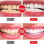 Yayashi Sp-4 Ultra Whitening Toothpaste Probiotic Stain Remover 120Gm /Nano Toothbrush Protects Gums Freshens Breath, for Everyone