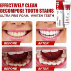 Yayashi Sp-4 Ultra Whitening Toothpaste Probiotic Stain Remover 120Gm / Stain Removing Toothpaste, Protects Gums Freshens Breath, for Everyone