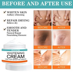 Pack Of 2 | Sensitive Area Whitening Cream for Private Parts, Underarms, Inner Thighs, and Dark Spot Lightening -30ml