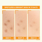 Garnier Skin Naturals Vitamin C Booster Serum 30ml – Bright Complete 30x Vitamin C Formula For Glowing, Spot-Free, And Radiant Skin
