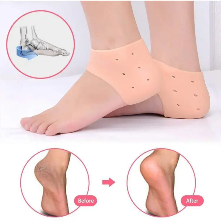 Pair of half Heel Pain Anti Crack Silicone Set - Anti Crack  For Pain Relief Unisex With Box