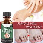 Fast Nail Fungus Treatment Gel – Nail Repair Essence Serum for Healthy, Smooth & Strong Nails