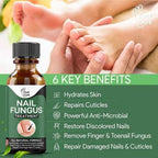 Fast Nail Fungus Treatment Gel – Nail Repair Essence Serum for Healthy, Smooth & Strong Nails
