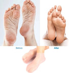 01 Pair - Silicone Foot Care Socks Anti Cracking Moisturizing Gel Socks Cracked Dead Skin Remove Protector - Silicone Socks And Gloves For Moisturizing Hands And Feet
