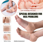 half Heel Pain Anti Crack Silicone Set - Anti Crack  For Pain Relief Unisex