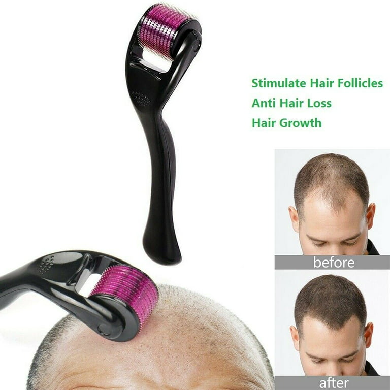 Professional Best Derma Roller Hair Therapy Micro-Needle | Derma Roller for Hair re-growth &amp; Skin For Male And Female
