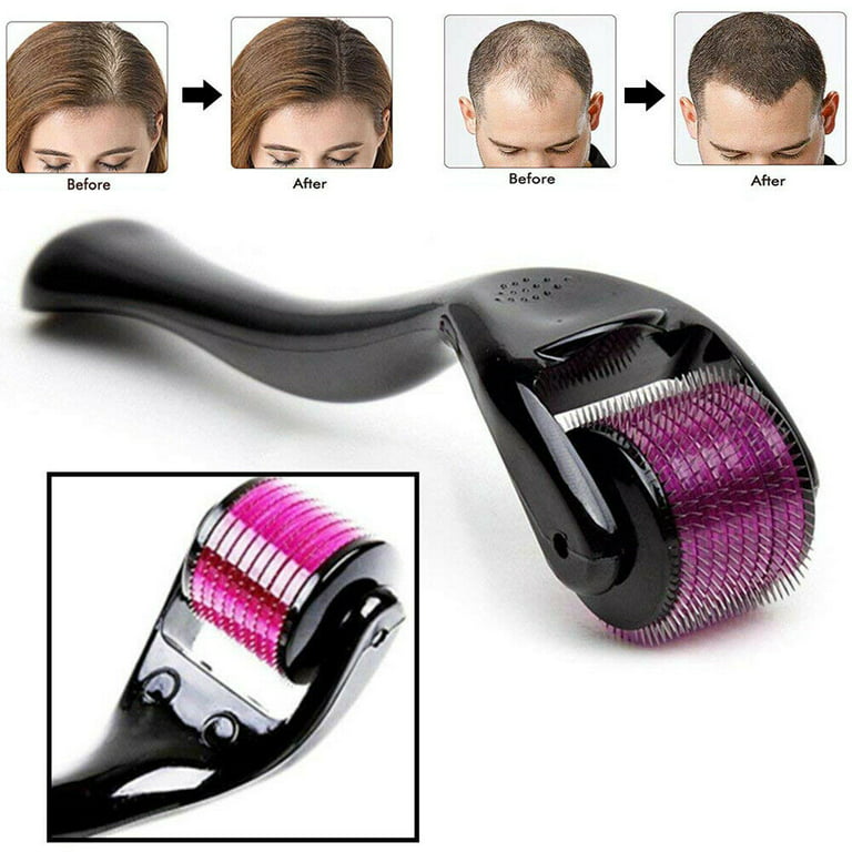 Professional Best Derma Roller Hair Therapy Micro-Needle | Derma Roller for Hair re-growth &amp; Skin For Male And Female