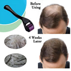 Professional Best Derma Roller Hair Therapy Micro-Needle | Derma Roller for Hair re-growth &amp; Skin For Male And Female
