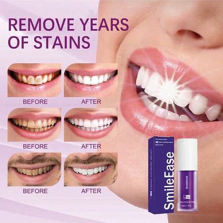 Teeth Brightening Hismiles V34 Colour Corrector Serum - 30ml | Best Quality Serum For Teeth Brightening