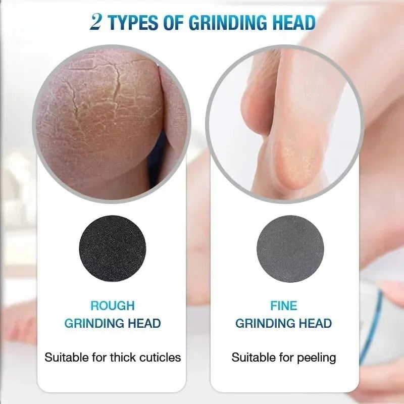 Back Callus Remover with Built-In Vacuum – Electric Foot Grinder for Dead Skin, Cracked Heels &amp; Calluses, Rechargeable Pedicure Tool with Gentle &amp; Powerful Exfoliation