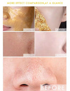 Dr Rashel Original Gold Peel Off Facial Mask – Glow Like Pure Gold – Deep Cleansing &amp; Radiant Glow - 100 ML