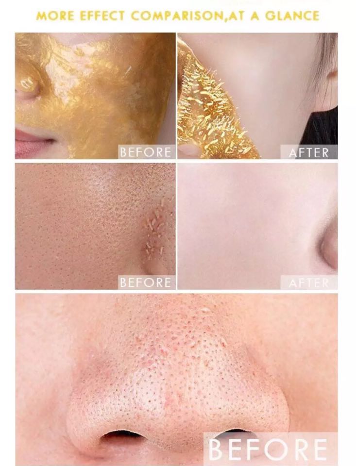 Dr Rashel Original Gold Peel Off Facial Mask – Glow Like Pure Gold – Deep Cleansing &amp; Radiant Glow - 100 ML