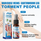 South Moon Varicose Veins Treatment Spray – 35ml Advanced Formula for Spider Veins, Leg Pain & Swelling Relief | Natural Herbal Spray for Better Circulation