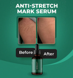 Markaway Stretch Mark Serum Herbal Formula for Scars & Skin Elasticity 30ml Nourishing, Repairing & Firming Skin Treatment