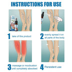 South Moon Varicose Veins Treatment Spray – 30ml Advanced Formula for Spider Veins, Leg Pain & Swelling Relief | Natural Herbal Spray for Better Circulation