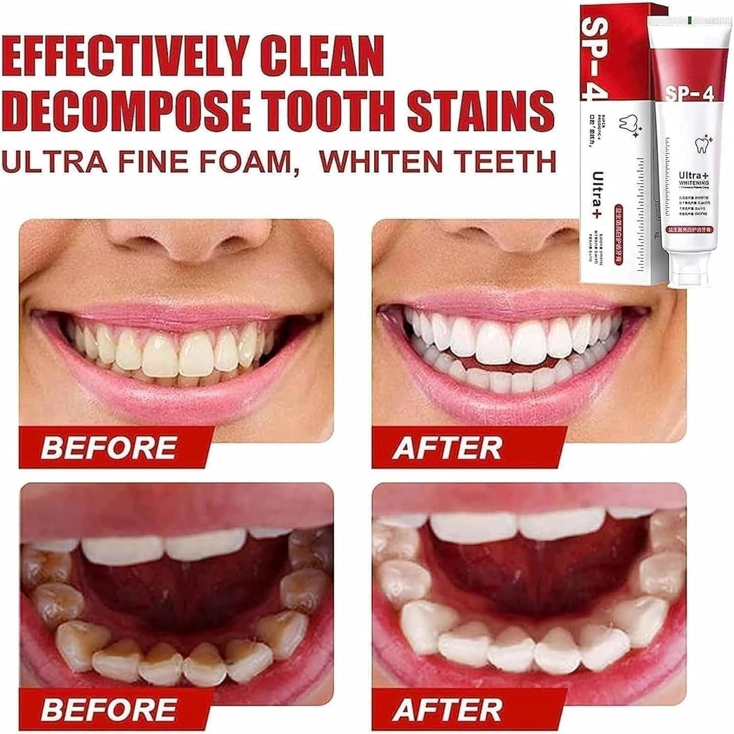 Yayashi Sp 4 Ultra Whitening Toothpaste Strong Stain Removal Fresh Breath Daily Oral Care - 120g