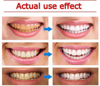 Yayashi SP-4 Ultra Whitening Toothpaste – 150ml Probiotic Stain Remover for Bright, Healthy Teeth