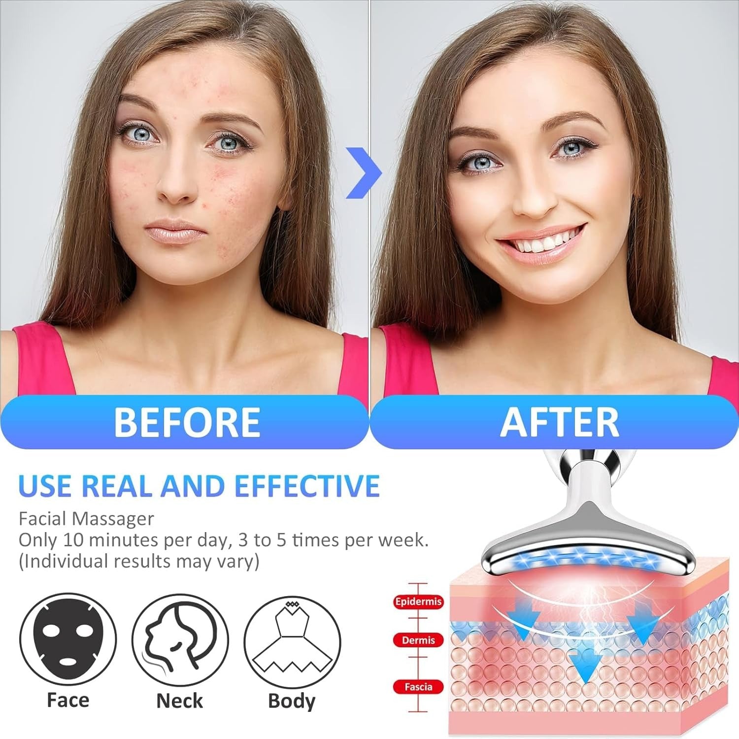 ES-1081 Massager Intense Pulsed Light Wrinkles Reducing Instrument - ESX - Anti Ageing &amp; Reduces Puffiness | Face Massager For Fine Line &amp; Wrinkles - Random Color